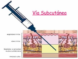 Vía Subcutánea   