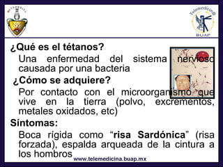 ¿Qué es el tétanos?
  Una enfermedad del sistema nervioso
  causada por una bacteria
¿Cómo se adquiere?
  Por contacto con el microorganismo que
  vive en la tierra (polvo, excrementos,
  metales oxidados, etc)
Síntomas:
  Boca rígida como “risa Sardónica” (risa
  forzada), espalda arqueada de la cintura a
  los hombros
 