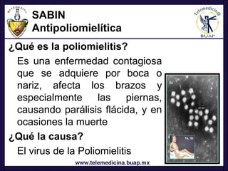 SABIN
     Antipoliomielítica
¿Qué es la poliomielitis?
 Es una enfermedad contagiosa
 que se adquiere por boca o
 nariz, afecta los brazos y
 especialmente       las    piernas,
 causando parálisis flácida, y en
 ocasiones la muerte
¿Qué la causa?
 El virus de la Poliomielitis
 