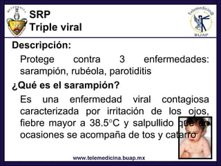 SRP
   Triple viral
Descripción:
 Protege     contra     3     enfermedades:
 sarampión, rubéola, parotiditis
¿Qué es el sarampión?
 Es una enfermedad viral contagiosa
 caracterizada por irritación de los ojos,
 fiebre mayor a 38.5°C y salpullido que en
 ocasiones se acompaña de tos y catarro
 