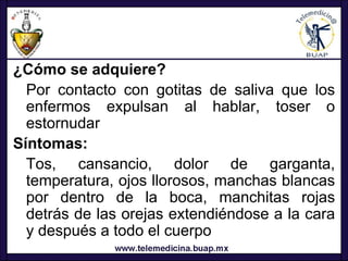 ¿Cómo se adquiere?
  Por contacto con gotitas de saliva que los
  enfermos expulsan al hablar, toser o
  estornudar
Síntomas:
  Tos, cansancio, dolor de garganta,
  temperatura, ojos llorosos, manchas blancas
  por dentro de la boca, manchitas rojas
  detrás de las orejas extendiéndose a la cara
  y después a todo el cuerpo
 