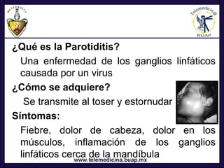 ¿Qué es la Parotiditis?
  Una enfermedad de los ganglios linfáticos
  causada por un virus
¿Cómo se adquiere?
   Se transmite al toser y estornudar
Síntomas:
  Fiebre, dolor de cabeza, dolor en los
  músculos, inflamación de los ganglios
  linfáticos cerca de la mandíbula
 