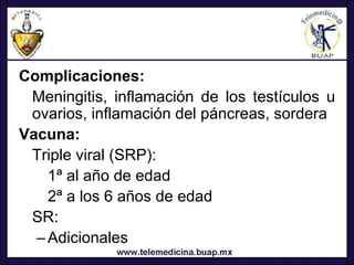 Complicaciones:
 Meningitis, inflamación de los testículos u
 ovarios, inflamación del páncreas, sordera
Vacuna:
 Triple viral (SRP):
    1ª al año de edad
    2ª a los 6 años de edad
 SR:
  – Adicionales
 