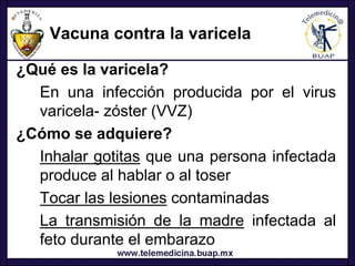 Vacuna contra la varicela

¿Qué es la varicela?
  En una infección producida por el virus
  varicela- zóster (VVZ)
¿Cómo se adquiere?
  Inhalar gotitas que una persona infectada
  produce al hablar o al toser
  Tocar las lesiones contaminadas
  La transmisión de la madre infectada al
  feto durante el embarazo
 