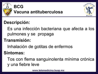 BCG
     Vacuna antituberculosa

Descripción:
  Es una infección bacteriana que afecta a los
  pulmones y se propaga
Transmisión:
  Inhalación de gotitas de enfermos
Síntomas:
  Tos con flema sanguinolenta mínima crónica
  y una fiebre leve
 