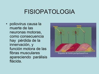 FISIOPATOLOGIA
• poliovirus causa la
  muerte de las
  neuronas motoras,
  como consecuencia
  hay pérdida de la
  innervación, y
  función motora de las
  fibras musculares
  apareciendo parálisis
  flácida.
 