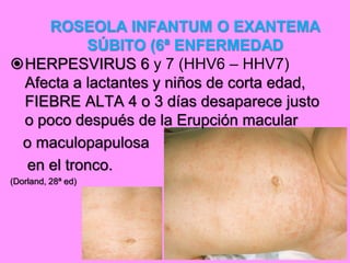 ROSEOLA INFANTUM O EXANTEMA
          SÚBITO (6ª ENFERMEDAD
HERPESVIRUS 6 y 7 (HHV6 – HHV7)
 Afecta a lactantes y niños de corta edad,
 FIEBRE ALTA 4 o 3 días desaparece justo
 o poco después de la Erupción macular
 o maculopapulosa
 en el tronco.
(Dorland, 28ª ed)
 