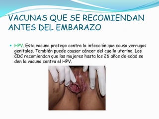 VACUNAS QUE SE RECOMIENDAN
ANTES DEL EMBARAZO

 HPV. Esta vacuna protege contra la infección que causa verrugas
  genitales. También puede causar cáncer del cuello uterino. Los
  CDC recomiendan que las mujeres hasta los 26 años de edad se
  den la vacuna contra el HPV.
 