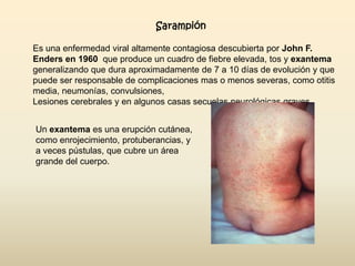 Sarampión
Es una enfermedad viral altamente contagiosa descubierta por John F.
Enders en 1960 que produce un cuadro de fiebre elevada, tos y exantema
generalizando que dura aproximadamente de 7 a 10 días de evolución y que
puede ser responsable de complicaciones mas o menos severas, como otitis
media, neumonías, convulsiones,
Lesiones cerebrales y en algunos casas secuelas neurológicas graves.
Un exantema es una erupción cutánea,
como enrojecimiento, protuberancias, y
a veces pústulas, que cubre un área
grande del cuerpo.

 