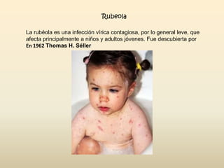 Rubeola
La rubéola es una infección vírica contagiosa, por lo general leve, que
afecta principalmente a niños y adultos jóvenes. Fue descubierta por
En 1962 Thomas H. Séller

 