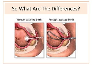 So What Are The Differences?
 