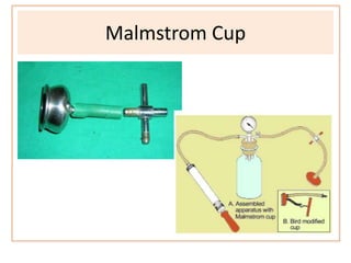 Malmstrom Cup
 