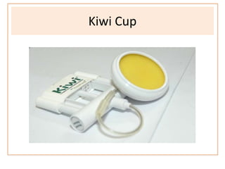 Kiwi Cup
 