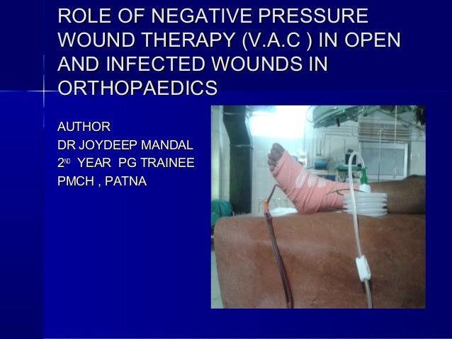 role of negative pressure wound therapy v a c in orthopaedics