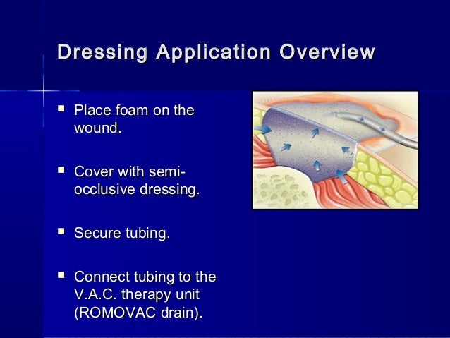 7 skin treatment number therapy pressure wound in (V.A.C) of Role negative