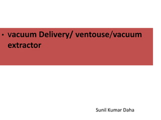 • Vacuum Delivery/ ventouse/vacuum
extractor
Sunil Kumar Daha
 