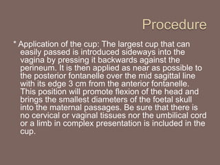 * Application of the cup: The largest cup that can
easily passed is introduced sideways into the
vagina by pressing it backwards against the
perineum. It is then applied as near as possible to
the posterior fontanelle over the mid sagittal line
with its edge 3 cm from the anterior fontanelle.
This position will promote flexion of the head and
brings the smallest diameters of the foetal skull
into the maternal passages. Be sure that there is
no cervical or vaginal tissues nor the umbilical cord
or a limb in complex presentation is included in the
cup.
 