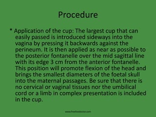 Procedure* Application of the cup: The largest cup that can easily passed is introduced sideways into the vagina by pressing it backwards against the perineum. It is then applied as near as possible to the posterior fontanelle over the mid sagittal line with its edge 3 cm from the anterior fontanelle. This position will promote flexion of the head and brings the smallest diameters of the foetal skull into the maternal passages. Be sure that there is no cervical or vaginal tissues nor the umbilical cord or a limb in complex presentation is included in the cup.www.freelivedoctor.com