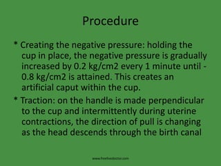 Procedure* Creating the negative pressure: holding the cup in place, the negative pressure is gradually increased by 0.2 kg/cm2 every 1 minute until - 0.8 kg/cm2 is attained. This creates an artificial caput within the cup.* Traction: on the handle is made perpendicular to the cup and intermittently during uterine contractions, the direction of pull is changing as the head descends through the birth canalwww.freelivedoctor.com
