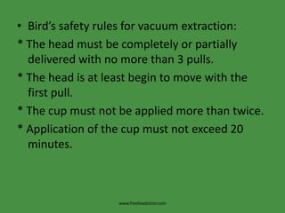 Bird’s safety rules for vacuum extraction:* The head must be completely or partially delivered with no more than 3 pulls.* The head is at least begin to move with the first pull.* The cup must not be applied more than twice.* Application of the cup must not exceed 20 minutes.www.freelivedoctor.com