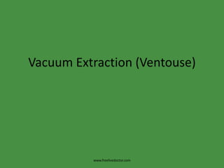 Vacuum Extraction (Ventouse) www.freelivedoctor.com 