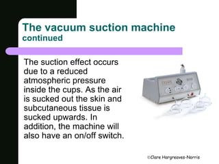 The vacuum suction machine 
continued 
Clare Hargreaves-Norris 
The suction effect occurs 
due to a reduced 
atmospheric pressure 
inside the cups. As the air 
is sucked out the skin and 
subcutaneous tissue is 
sucked upwards. In 
addition, the machine will 
also have an on/off switch. 
 