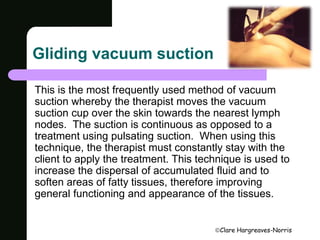 Clare Hargreaves-Norris 
Gliding vacuum suction 
This is the most frequently used method of vacuum 
suction whereby the therapist moves the vacuum 
suction cup over the skin towards the nearest lymph 
nodes. The suction is continuous as opposed to a 
treatment using pulsating suction. When using this 
technique, the therapist must constantly stay with the 
client to apply the treatment. This technique is used to 
increase the dispersal of accumulated fluid and to 
soften areas of fatty tissues, therefore improving 
general functioning and appearance of the tissues. 
 