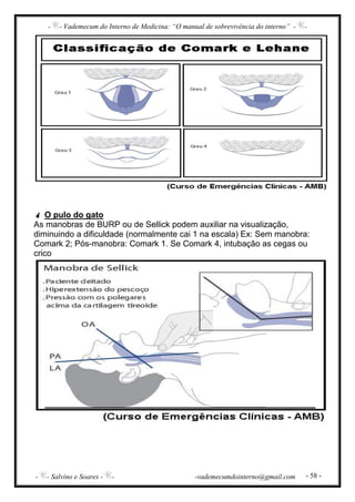 - - Vademecum do Interno de Medicina: “O manual de sobrevivência do interno” - -
- - Salvino e Soares - - -vademecumdointerno@gmail.com - 58 -
O pulo do gato
As manobras de BURP ou de Sellick podem auxiliar na visualização,
diminuindo a dificuldade (normalmente cai 1 na escala) Ex: Sem manobra:
Comark 2; Pós-manobra: Comark 1. Se Comark 4, intubação as cegas ou
crico
 