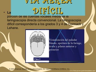 • Laringoscopia difícil: No se puede visualizar ninguna
porción de las cuerdas vocales mediante la
laringoscopia directa convencional. La laringoscopia
difícil correspondería a los grados 3 y 4 de Cormack y
Lehane.
VÍA AÉREAVÍA AÉREA
DIFÍCILDIFÍCIL
© 2003 American Society of Anesthesiologists, Inc. Lippincott Williams & Wilkins, Inc.
 