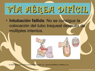 • Intubación fallida: No se consigue la
colocación del tubo traqueal después de
múltiples intentos.
© 2003 American Society of Anesthesiologists, Inc. Lippincott Williams & Wilkins, Inc.
VÍA AÉREA DIFÍCILVÍA AÉREA DIFÍCIL
 