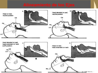 Alineamiento de los Ejes
33
www.reeme.arizona.edu
 