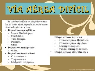 VÍA AÉREA DIFÍCILVÍA AÉREA DIFÍCIL
 