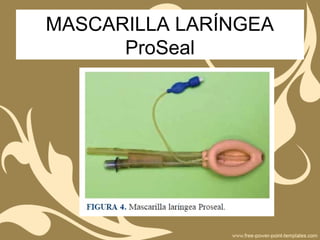 MASCARILLA LARÍNGEA
ProSeal
 