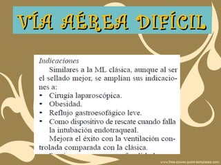 VÍA AÉREA DIFÍCILVÍA AÉREA DIFÍCIL
 