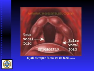 Ojalá siempre fuera así de fácil....…
 