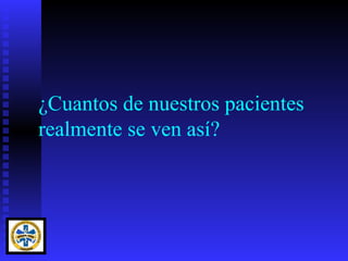 ¿Cuantos de nuestros pacientes
realmente se ven así?
 