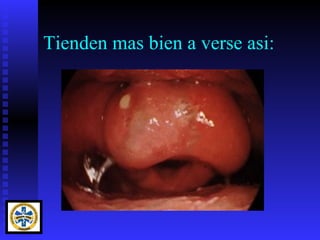 Tienden mas bien a verse asi:
 