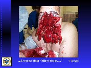 ...Entonces dije: “Miren todos.....”   y luego!
 