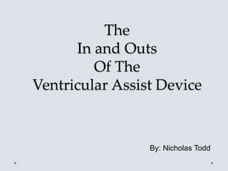 The
In and Outs
Of The
Ventricular Assist Device
By: Nicholas Todd
 
