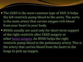 Ventricular Assist Device | PPTX
