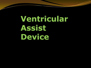 Ventricular
Assist
Device
 