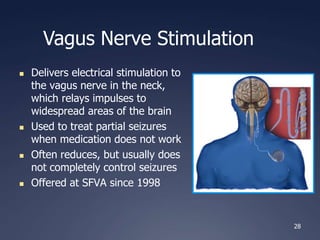 28
Vagus Nerve Stimulation
 Delivers electrical stimulation to
the vagus nerve in the neck,
which relays impulses to
widespread areas of the brain
 Used to treat partial seizures
when medication does not work
 Often reduces, but usually does
not completely control seizures
 Offered at SFVA since 1998

 