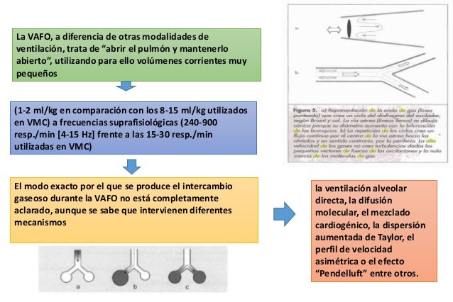 ventilaci 243 n alta frecuencia y oni ventilaci 243 n alta frecuencia y oni