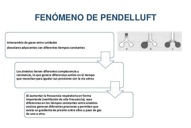 ventilaci 243 n alta frecuencia y oni ventilaci 243 n alta frecuencia y oni
