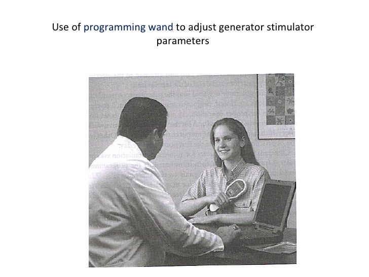 Vagal Nerve Stimulation for epilepsy