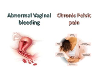 Abnormal Vaginal bleeding Chronic Pelvic pain
 