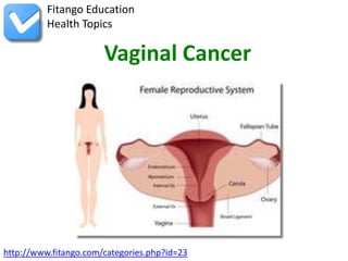 Fitango Education
          Health Topics

                       Vaginal Cancer




http://www.fitango.com/categories.php?id=23
 