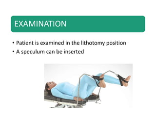 EXAMINATION
• Patient is examined in the lithotomy position
• A speculum can be inserted
 
