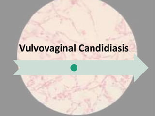 Vulvovaginal Candidiasis
 