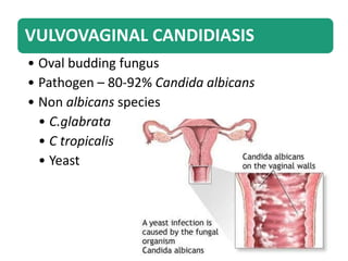 VULVOVAGINAL CANDIDIASIS
• Oval budding fungus
• Pathogen – 80-92% Candida albicans
• Non albicans species
• C.glabrata
• C tropicalis
• Yeast
 